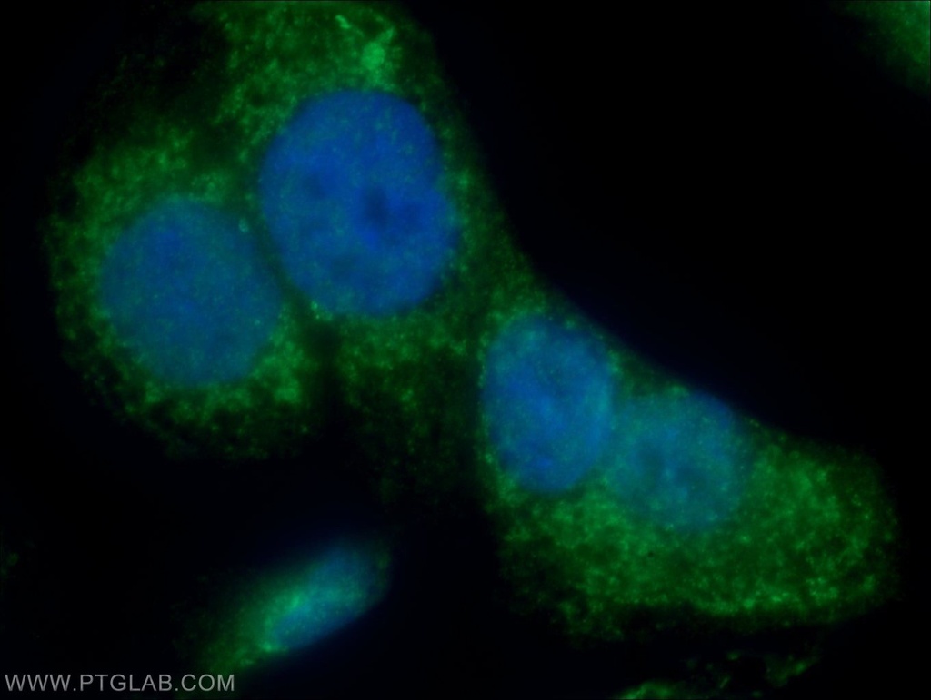 IQCK Polyclonal antibody