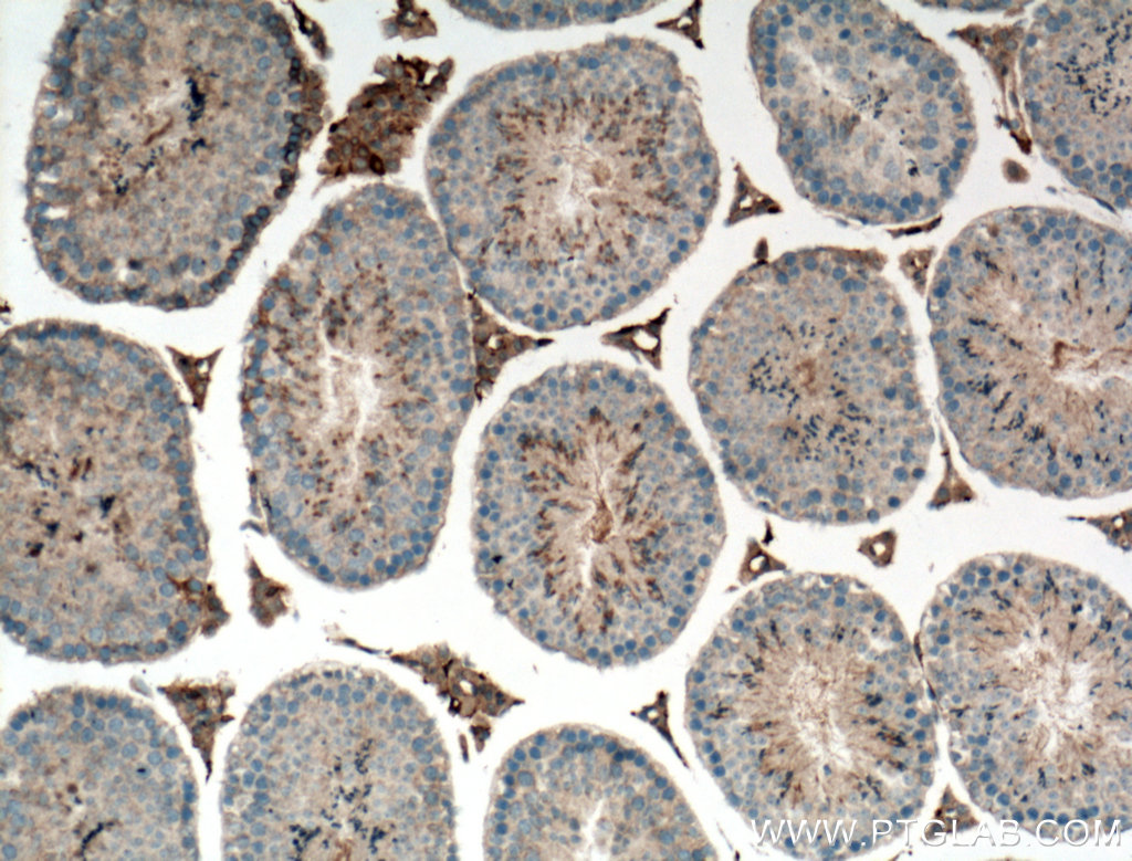 C1orf113 Polyclonal antibody