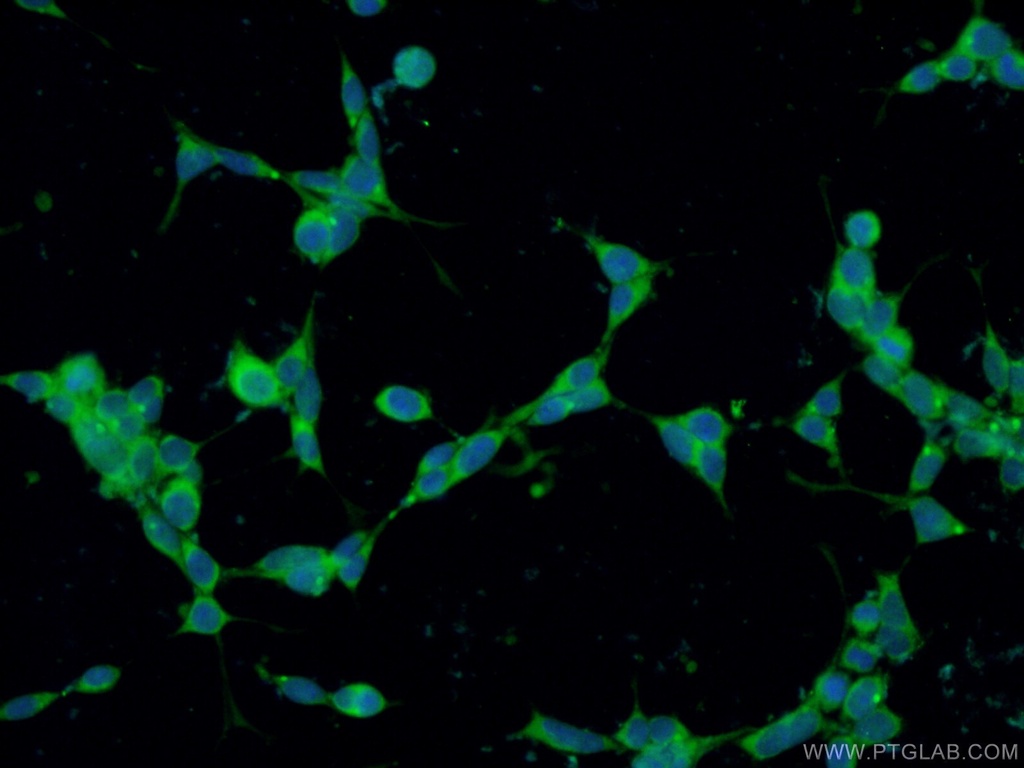 CCDC88C Polyclonal antibody