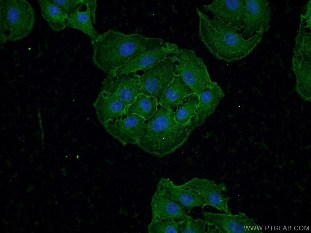 Drebrin Polyclonal antibody