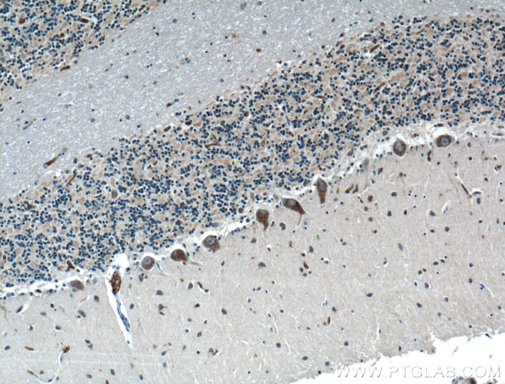 LRP2BP Polyclonal antibody