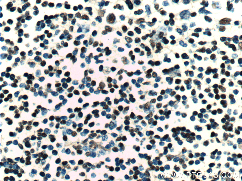 ZC3H18 Polyclonal antibody