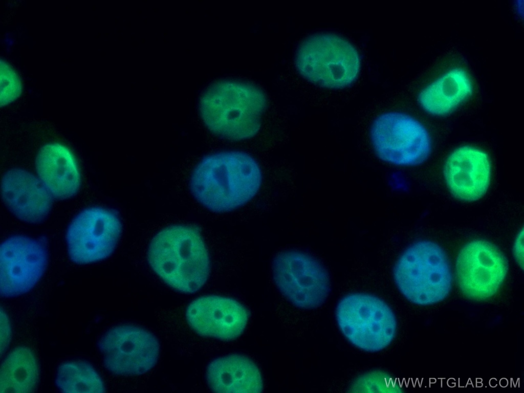 PR Polyclonal antibody