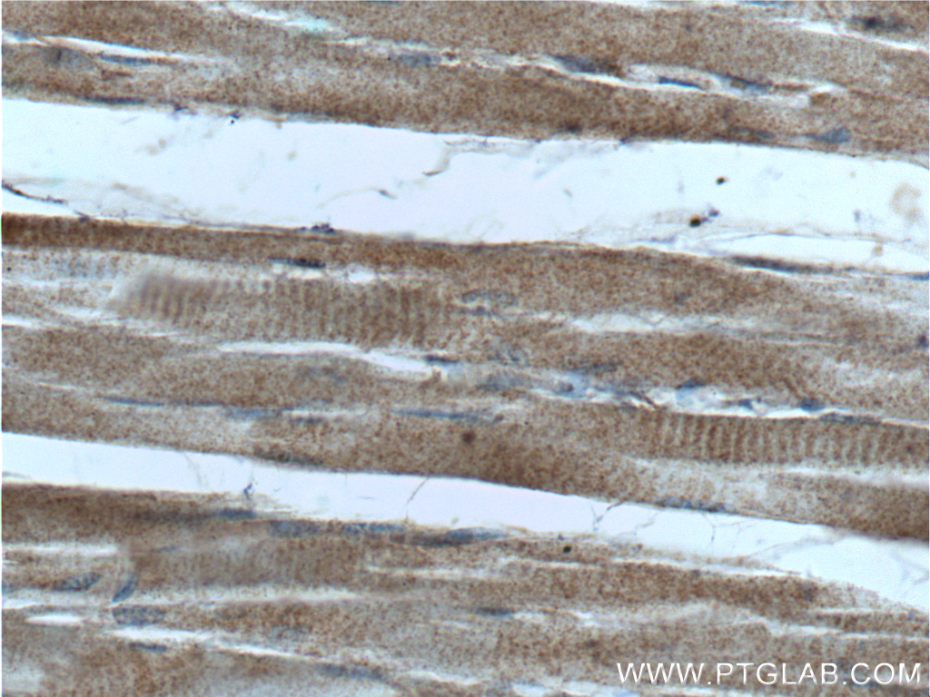 HKDC1 Polyclonal antibody