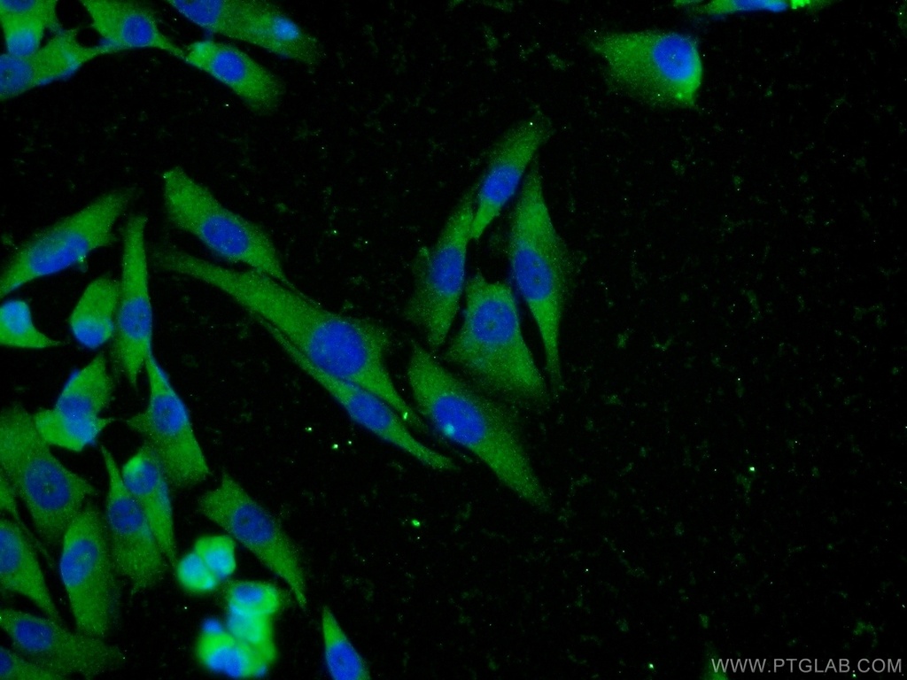 MTR Polyclonal antibody