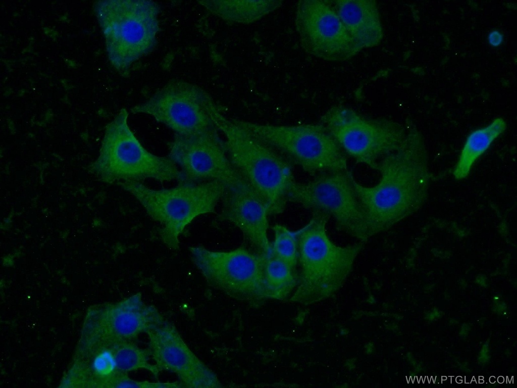 KIF5C Polyclonal antibody