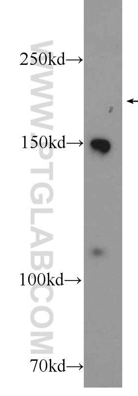 PIK3C2G Polyclonal antibody
