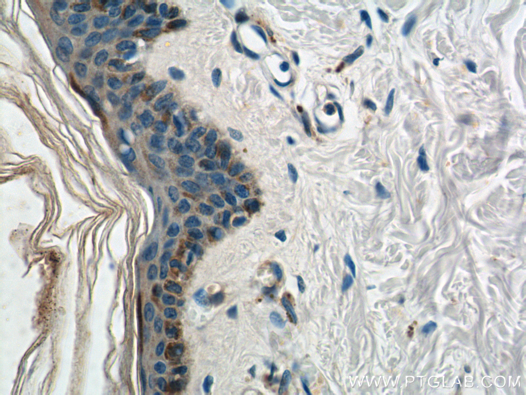 HAL Polyclonal antibody