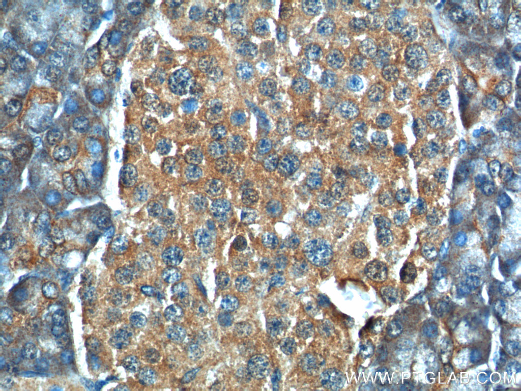 C11orf80 Polyclonal antibody