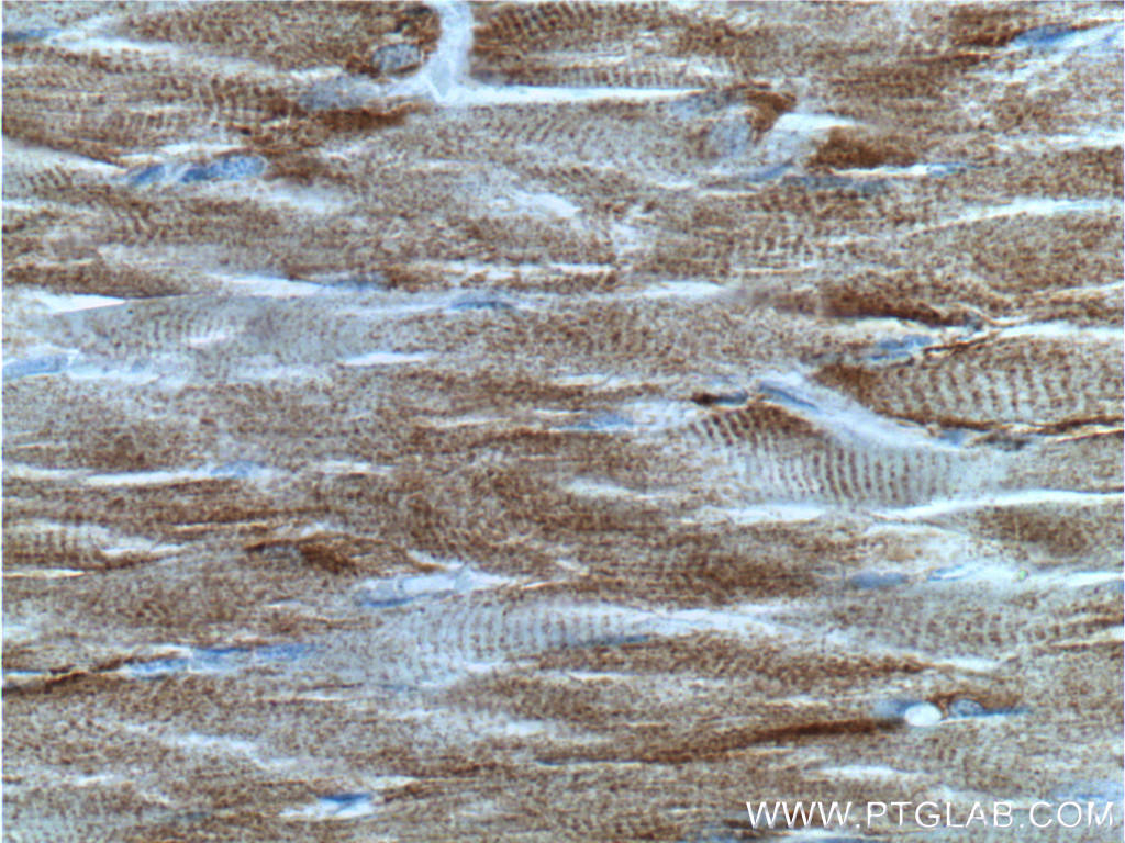 JPH1 Polyclonal antibody