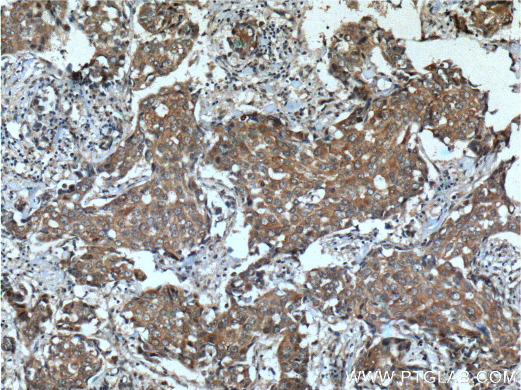 KIAA0090 Polyclonal antibody
