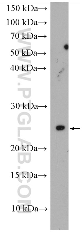 CEP19 Polyclonal antibody
