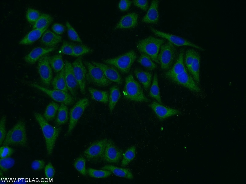 PARP10 Polyclonal antibody