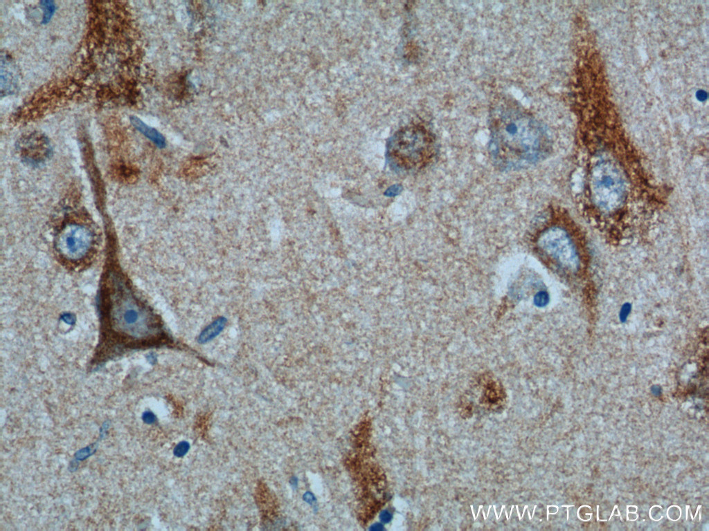 C1orf9 Polyclonal antibody