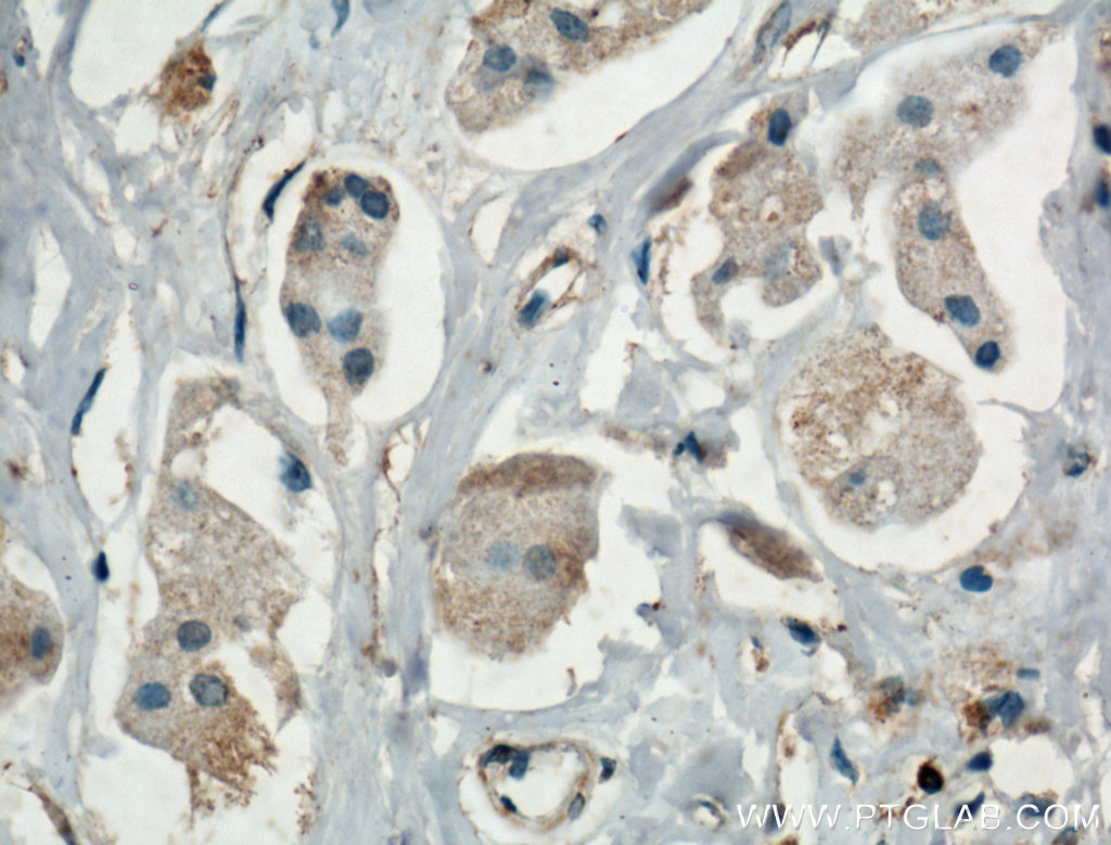 MAPK4 Polyclonal antibody