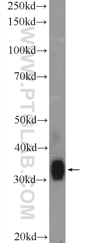 FLJ25006 Polyclonal antibody