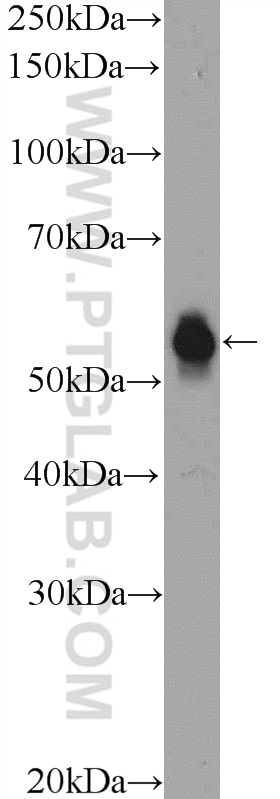 TEKT5 Polyclonal antibody