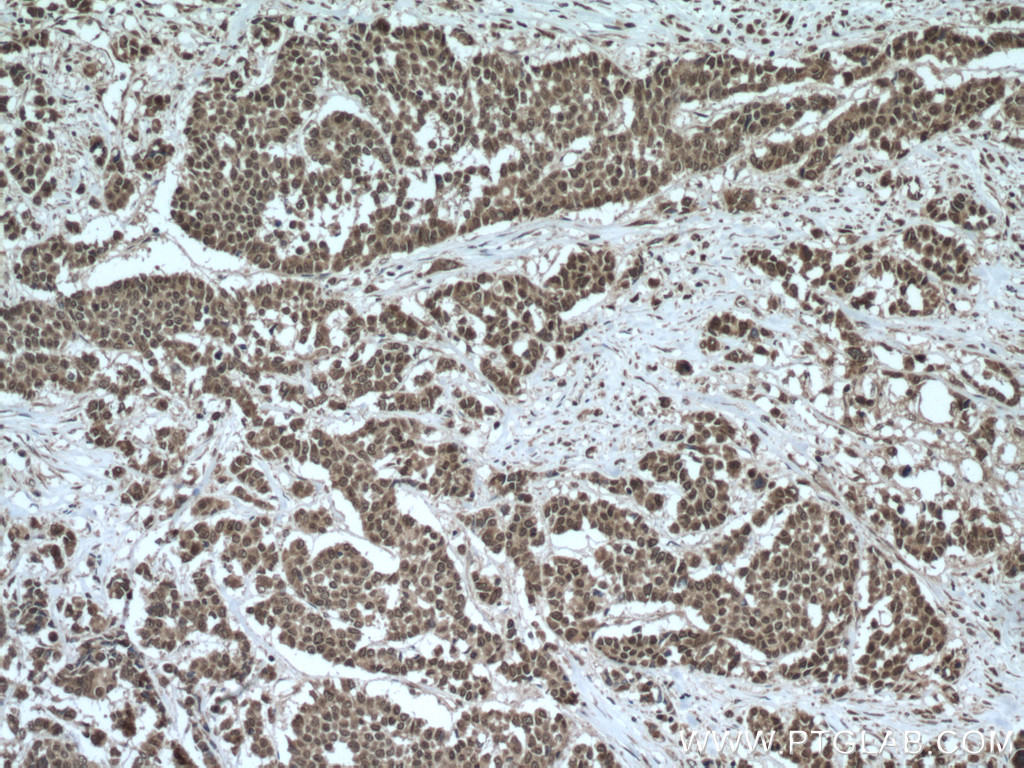 TTC5 Polyclonal antibody
