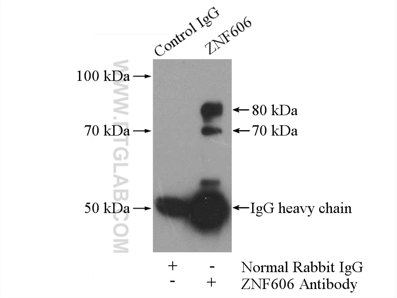 ZNF606 Polyclonal antibody