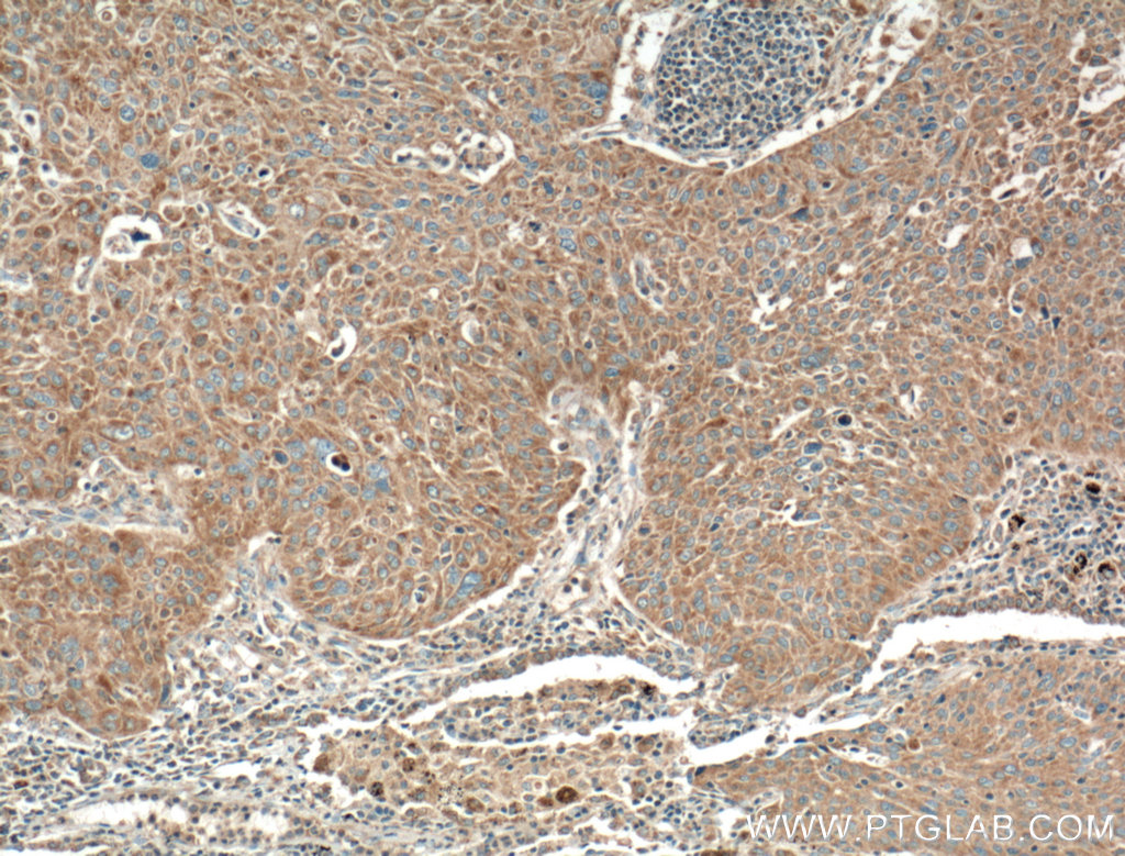 RGS11 Polyclonal antibody