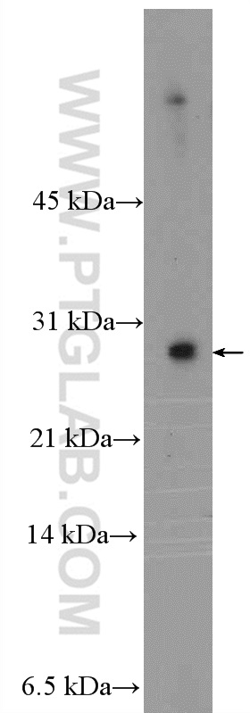 MYEOV2 Polyclonal antibody