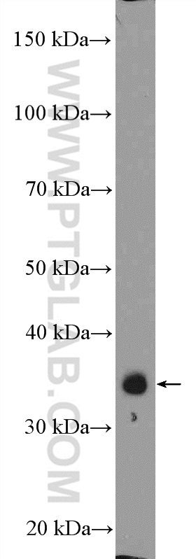 ZC3H8 Polyclonal antibody