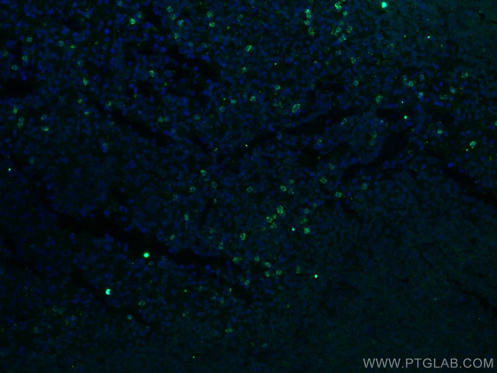 IL-17a Polyclonal antibody