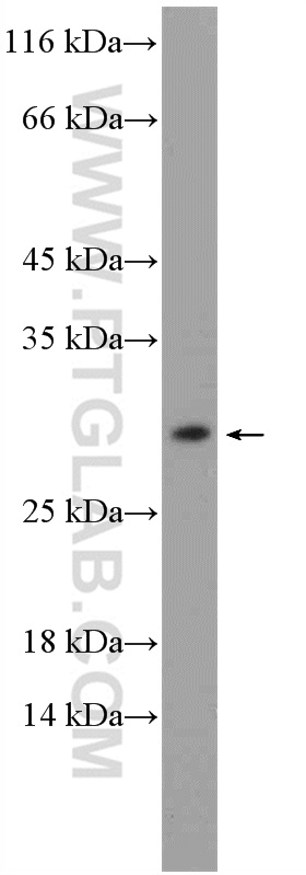 MOSPD3 Polyclonal antibody