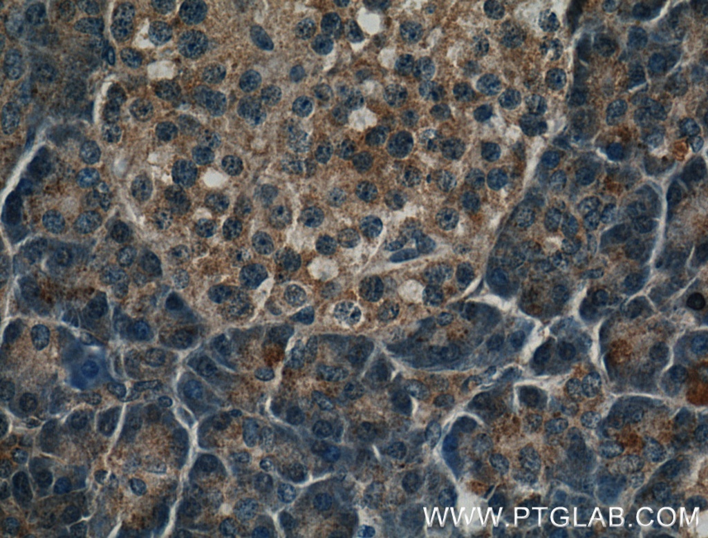PNLIPRP2 Polyclonal antibody