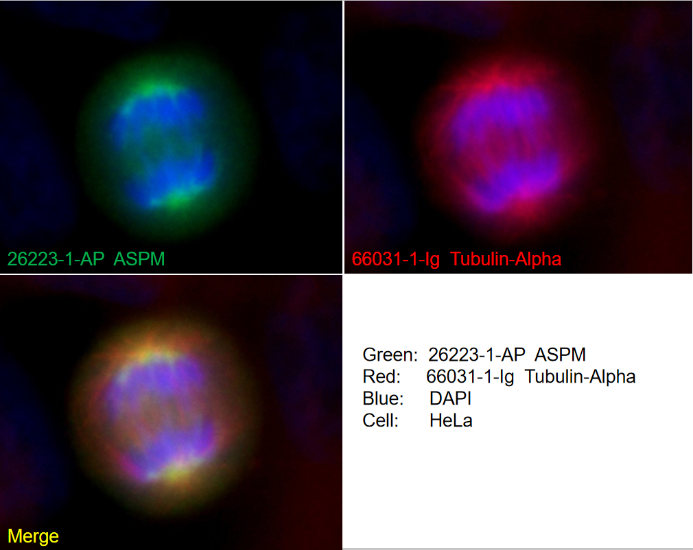 ASPM Polyclonal antibody