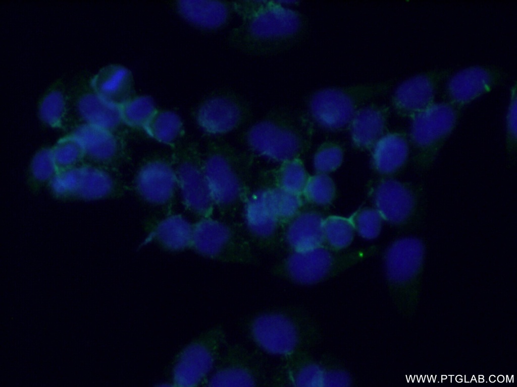 PPAPDC2 Polyclonal antibody