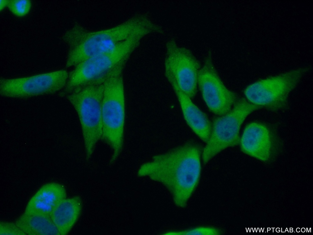 ZC3H15 Polyclonal antibody
