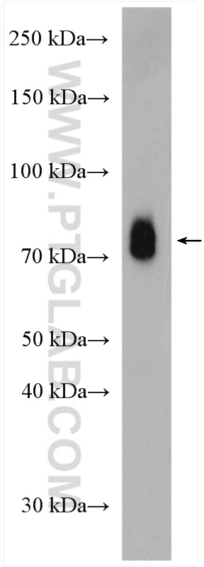 HRG Polyclonal antibody