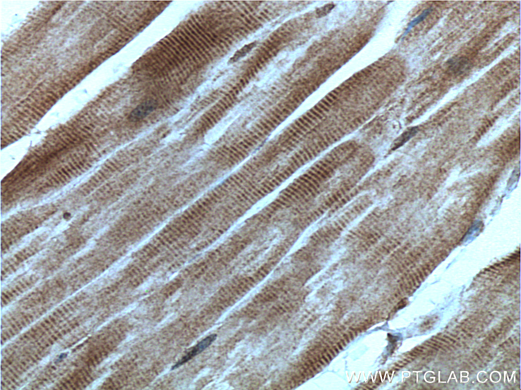 TRIM7 Polyclonal antibody