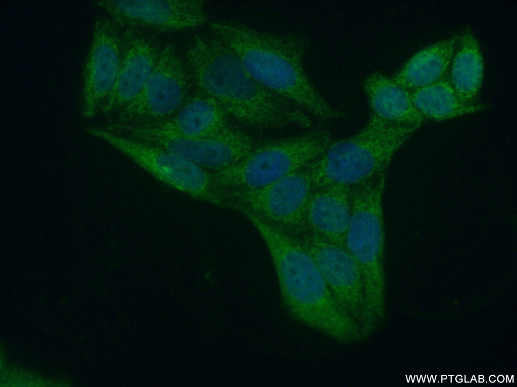 ZNF385A Polyclonal antibody