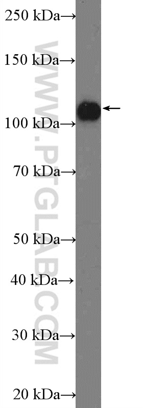 ANKLE2 Polyclonal antibody