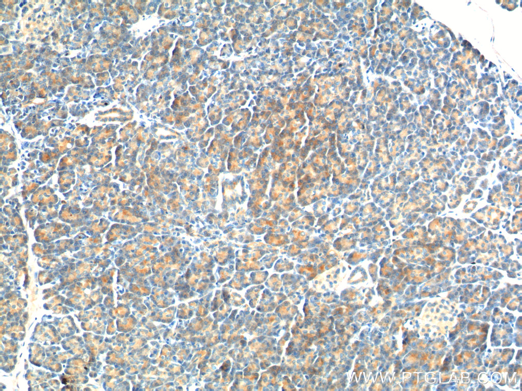 YRDC Polyclonal antibody