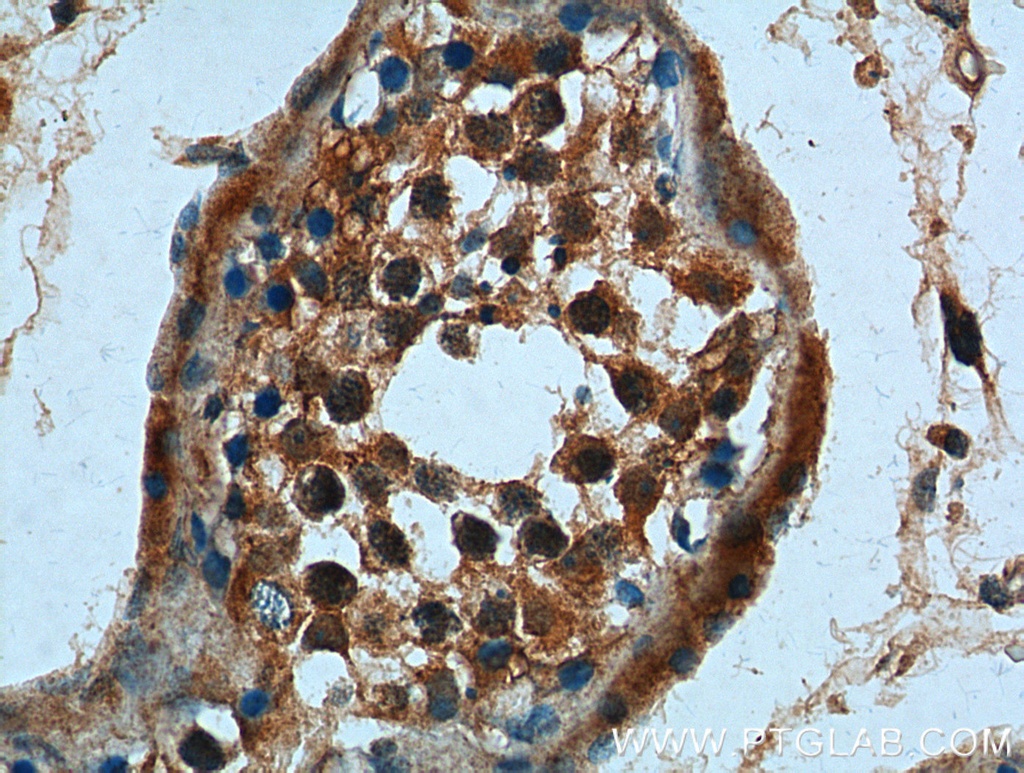 CCDC68 Polyclonal antibody