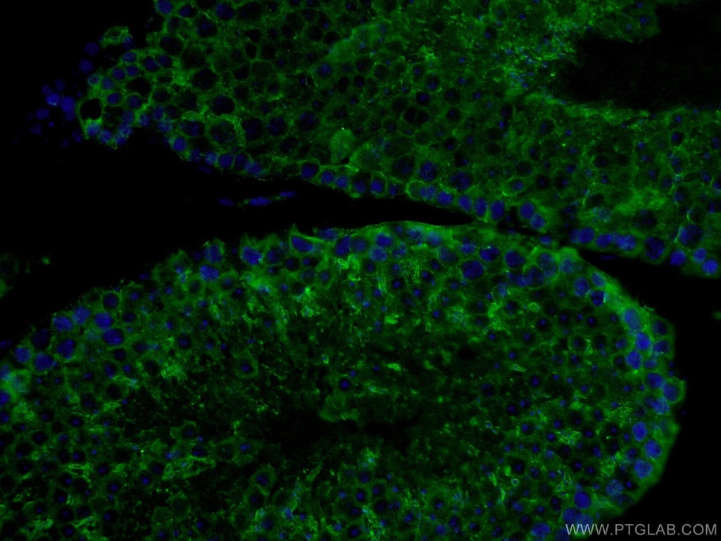 PDILT Polyclonal antibody