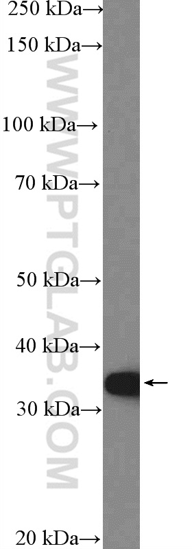MCU/CCDC109A Polyclonal antibody