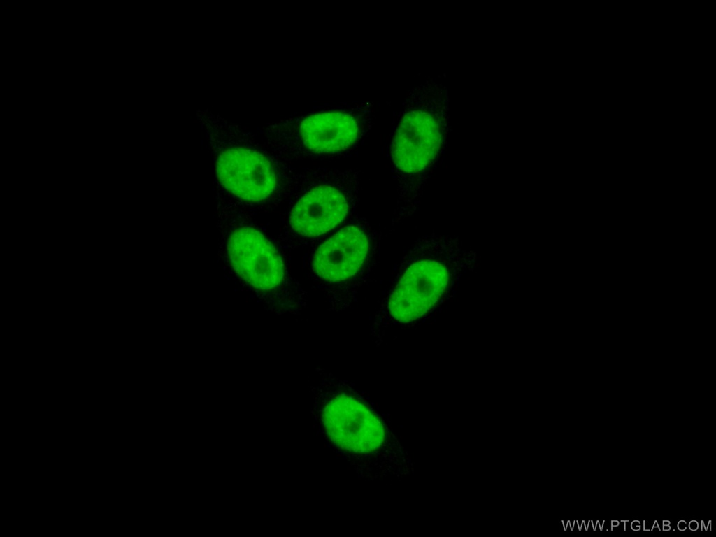 ZNF828 Polyclonal antibody
