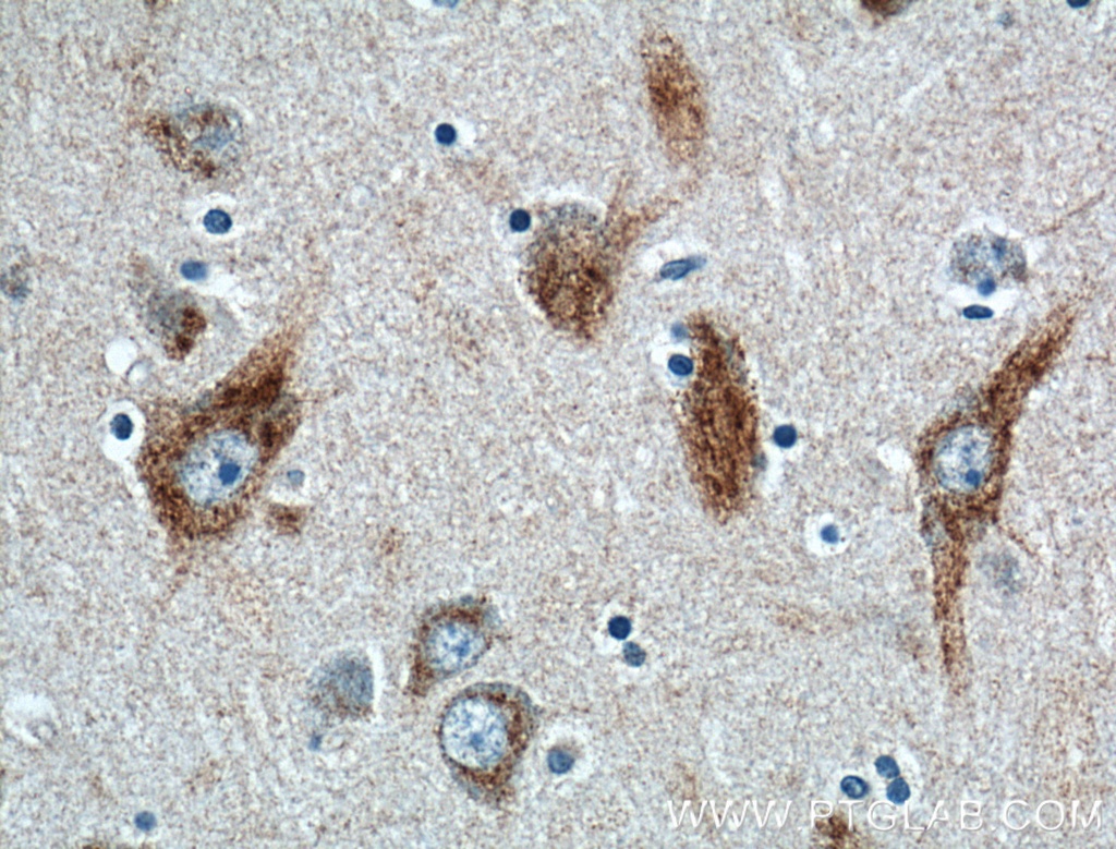 HTR2B Polyclonal antibody