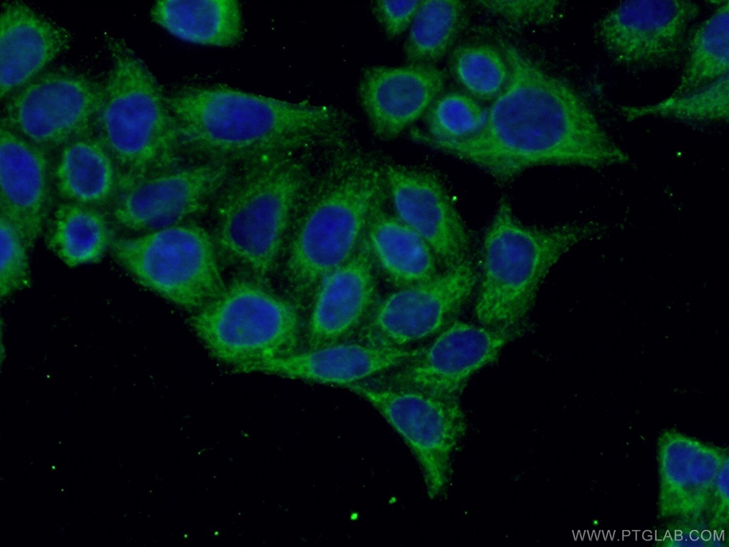 cGAS Polyclonal antibody