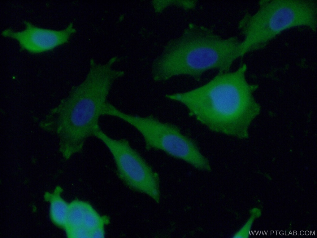 ENAH Polyclonal antibody
