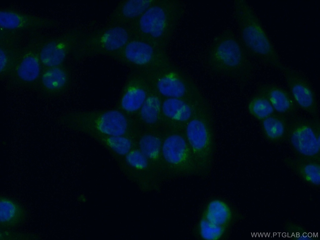 GMAP-210 Polyclonal antibody