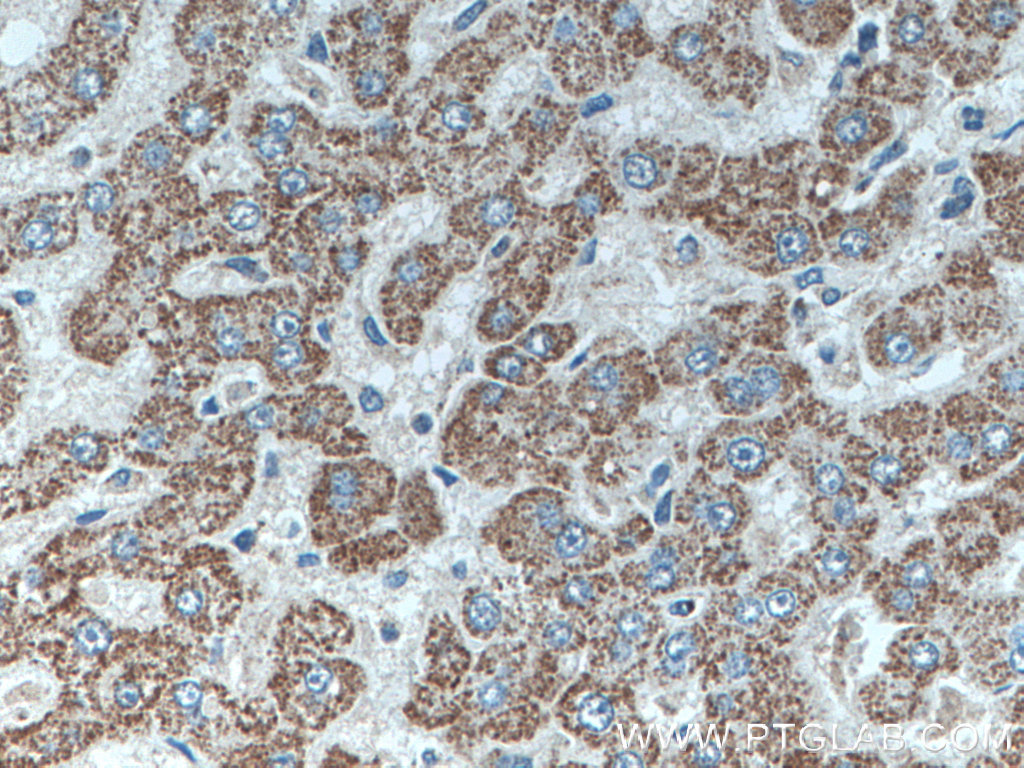 SLC2A9 Polyclonal antibody