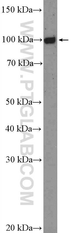 FCRL5 Polyclonal antibody