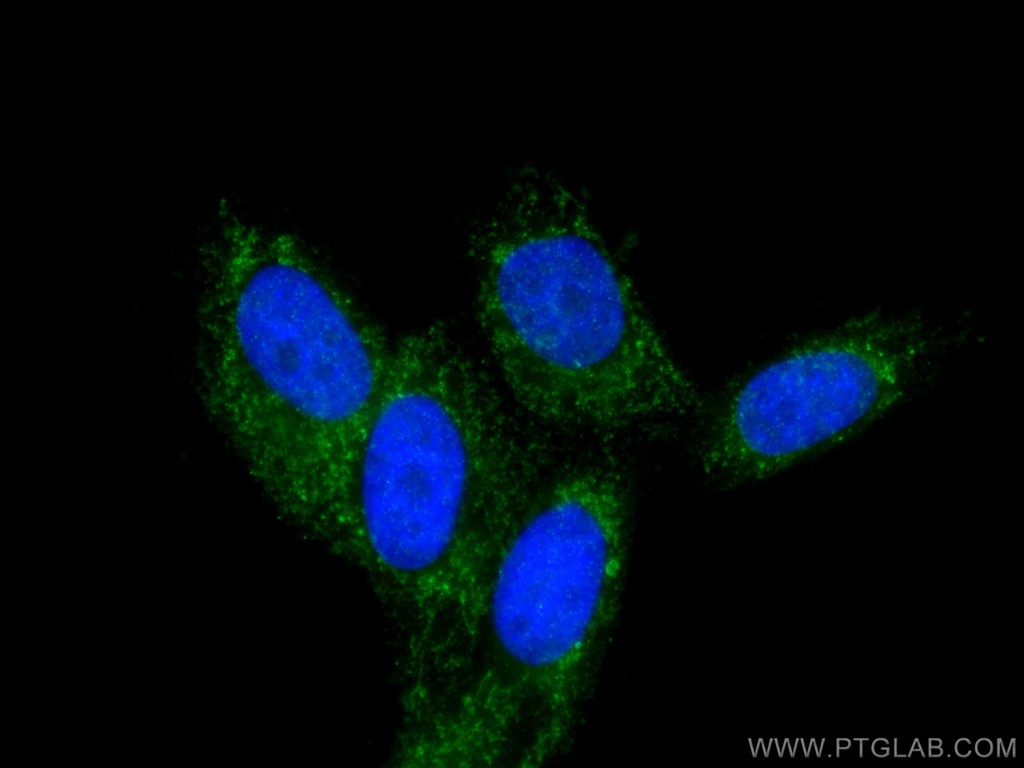 SDHD Polyclonal antibody