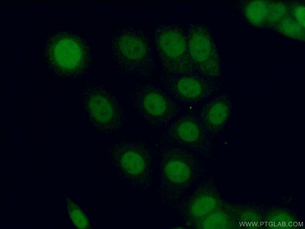 PPM1D Polyclonal antibody