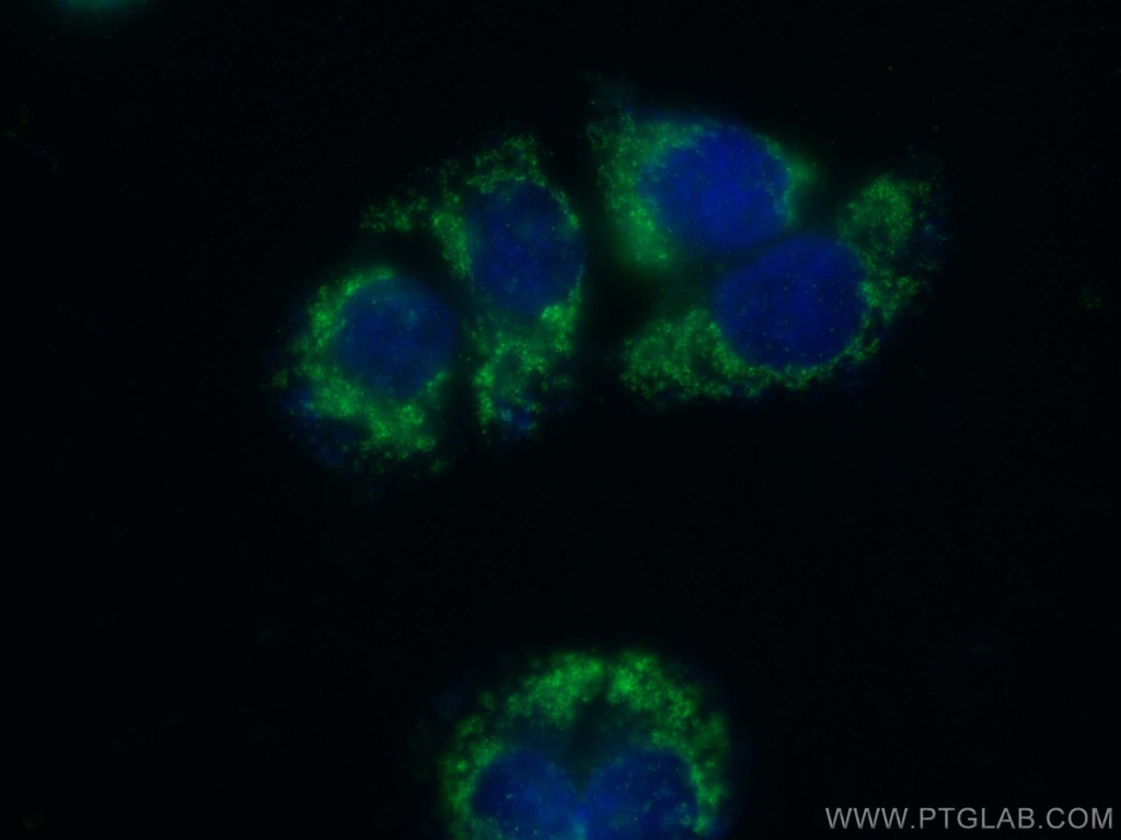 PMPCA Polyclonal antibody